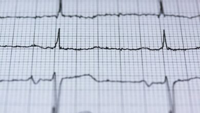 apex pulse opportunity engine